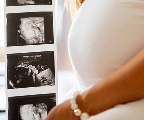 Napredovanje bebe po mjesecima - visina i težina bebe u prvih 12 mjeseci 