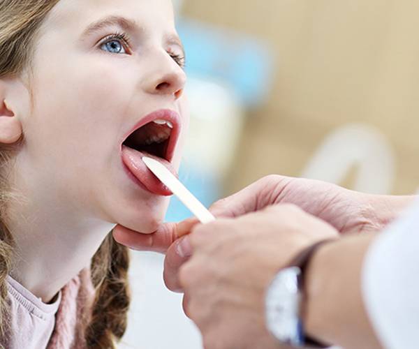 Upala krajnika (tonsilitis) kod djece i odraslih 