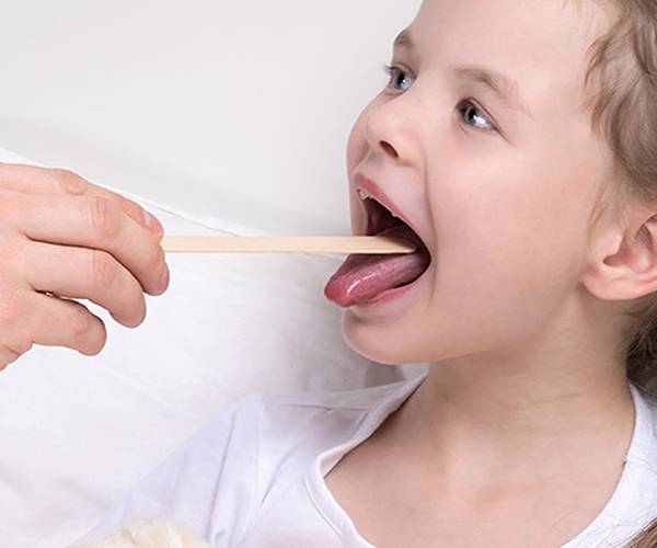 Virusi napadaju nosiće i grlo -   85% virusnih infekcija kod djece su faringitis i rinofaringitis 